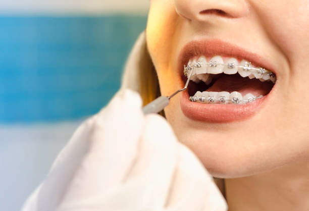 Orthodontic Treatment at Dental Associates of NJ in Bayonne
